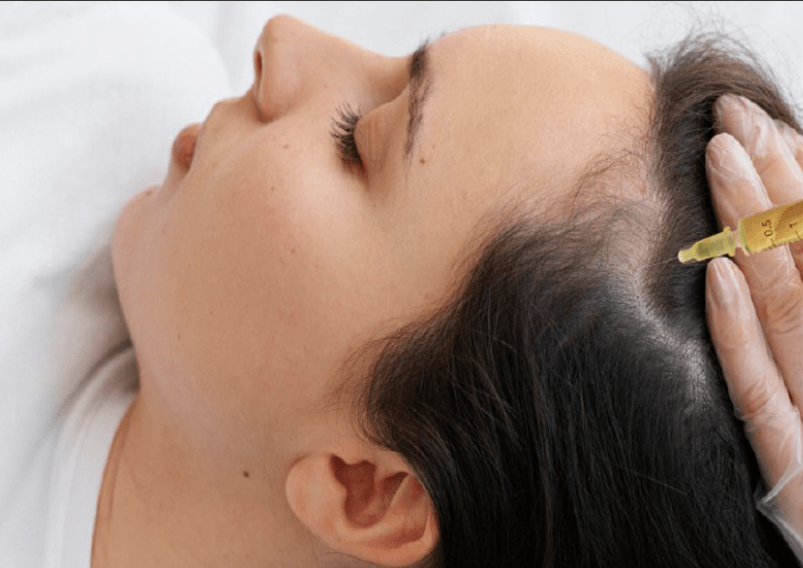 PRP (Platelet-rich Plasma)