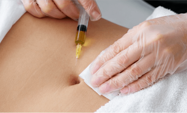 Fat Dissolving Injections
